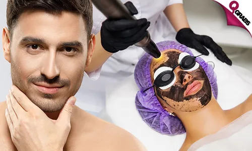 Carbon Peel & Laser Lightening or Toning Treatments!